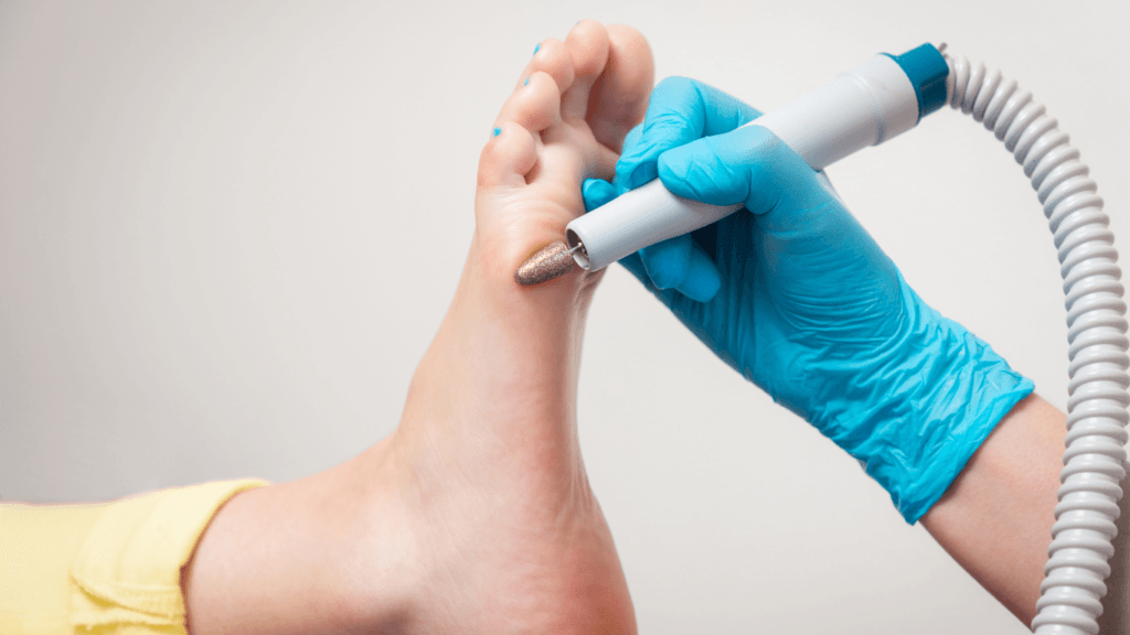 Diabetic foot care Ottawa
